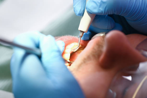 Best Emergency Treatment for Toothache in Farmland, IN