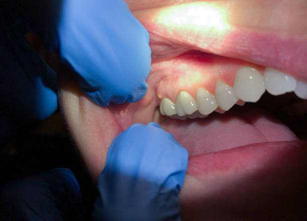Best Same-Day Emergency Dentist in Farmland, IN