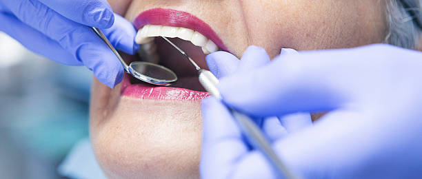 Best Emergency Wisdom Teeth Removal in Farmland, IN